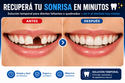 Resina de dientes / Recuperá tu sonrisa en minutos 🦷✨